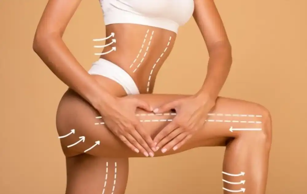 Body Lift en Tunisie : Redéfinissez Votre Silhouette en Toute Confiance