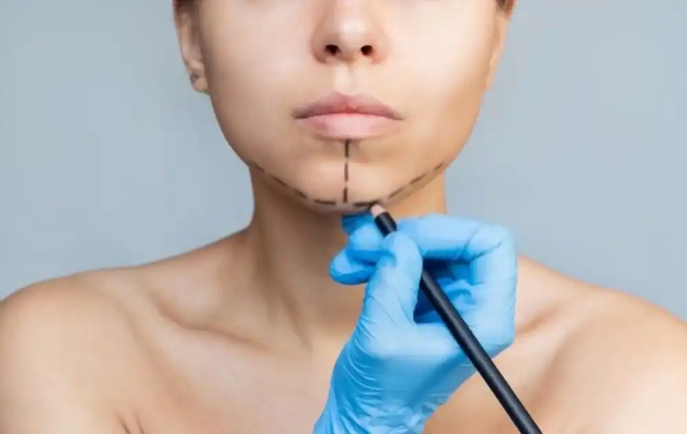Genioplastie en Tunisie : Sublimez Votre Profil avec Medica Tour