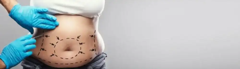Abdominoplastie en Tunisie : Retrouver Confiance en Votre Corps