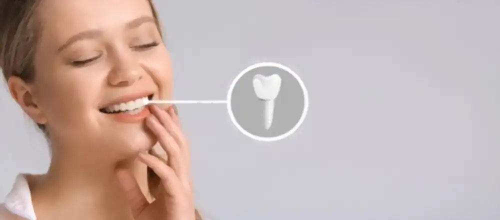 Implant Dentaire en Tunisie : Retrouver Votre Sourire avec Confiance